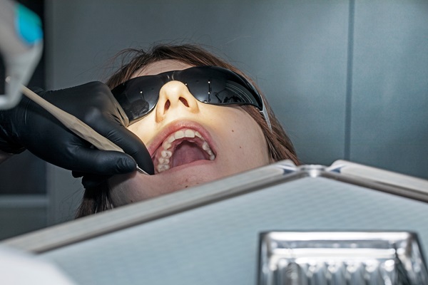 When A Deep Teeth Cleaning Is Recommended For Periodontal Health