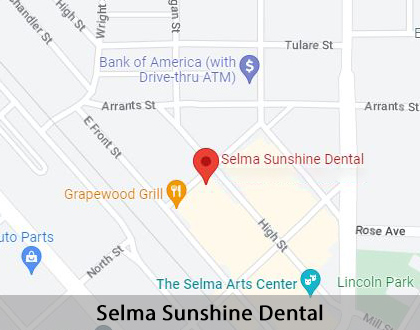Map image for Dental Implants in Selma, CA