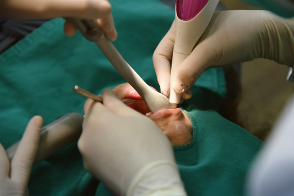 What Oral Surgeries Does A General Dentist Perform?